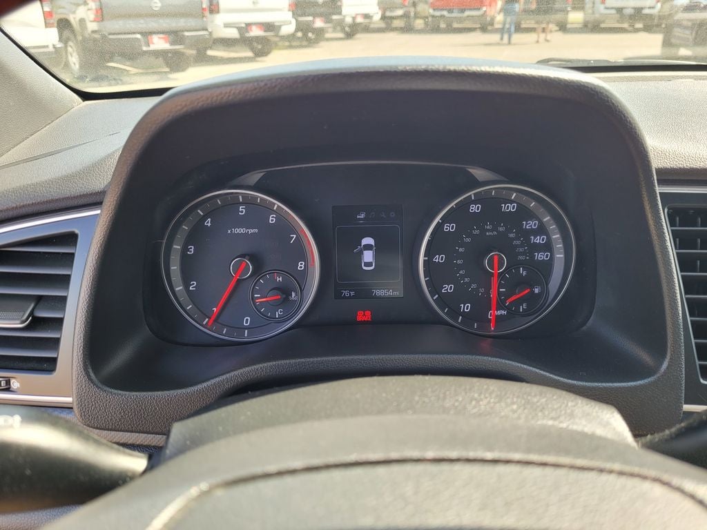 2017 Hyundai Elantra Sport