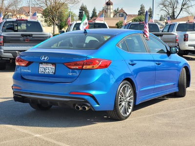 2017 Hyundai Elantra Sport